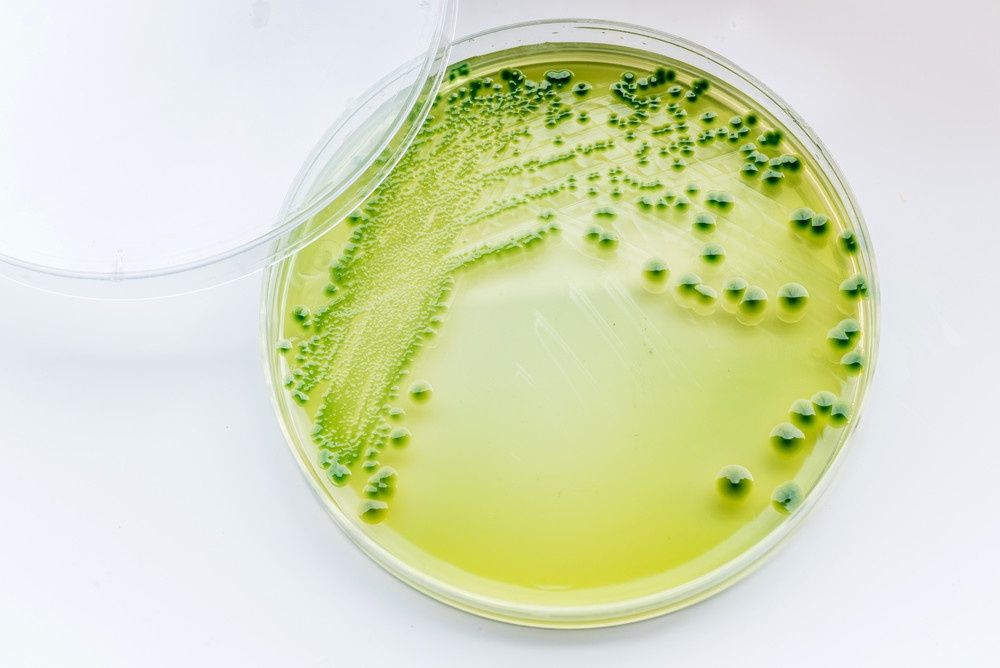 Vibrio